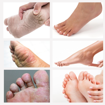 HIDRATANTE PARA CUERPO CON NIACINAMIDA+CERAMIDAS + ENVÍO GRATIS